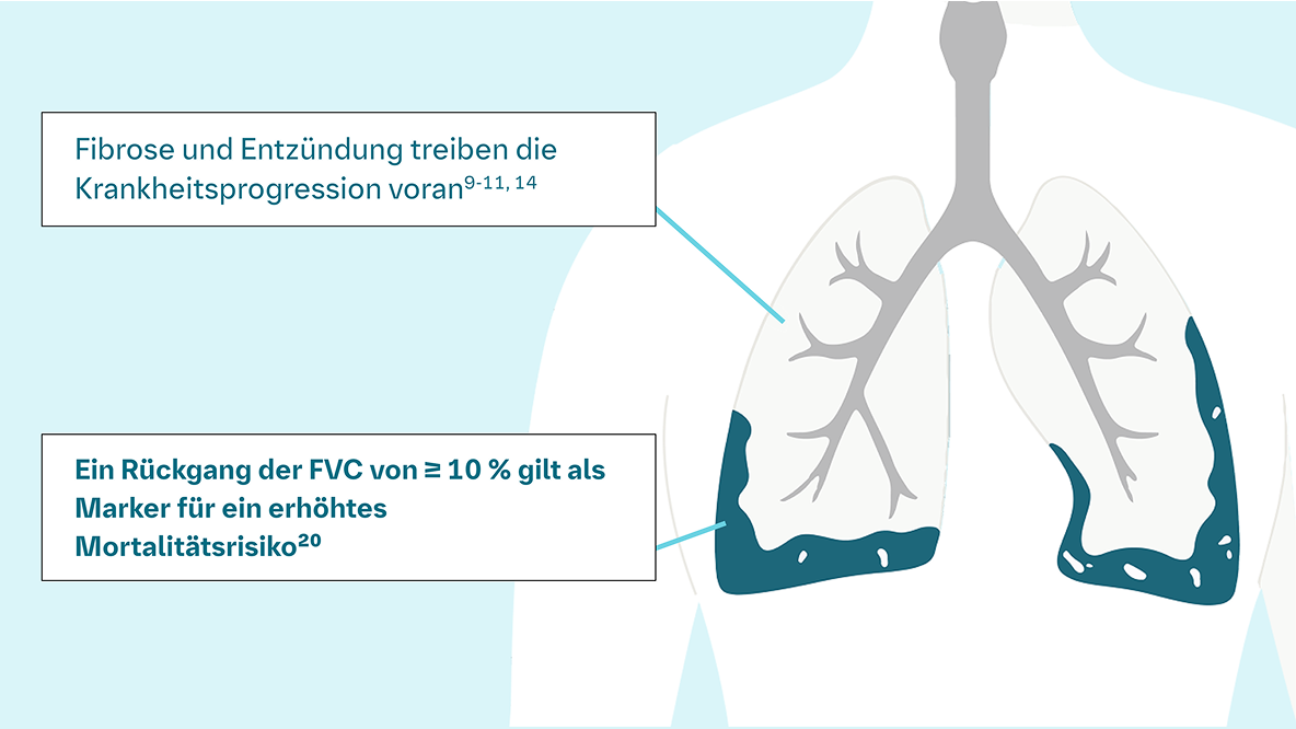 PPF-eine-Gefahr